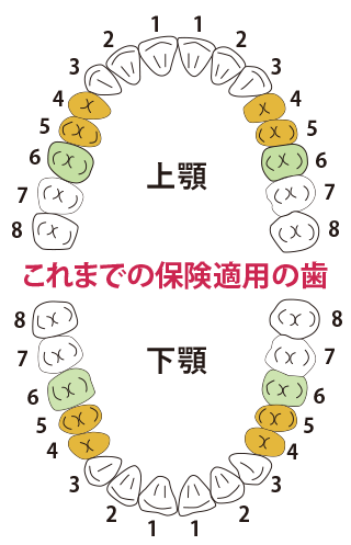 前歯部をジャケット冠治療前の画像