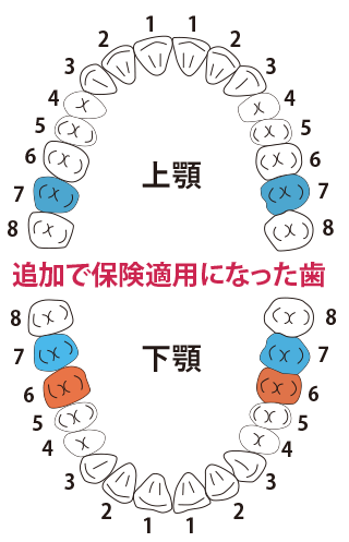 前歯部をジャケット冠治療後の画像