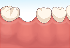 診断と治療計画の画像