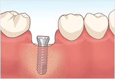 診断と治療計画の画像