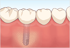 診断と治療計画の画像