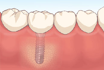 短い待ち時間のイメージ